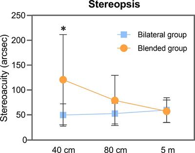Stereopsis and visual acuity: Bilateral trifocal versus blended extended depth of focus and diffractive bifocal intraocular lenses
